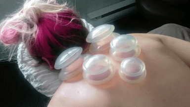 Image for Intro To Cupping for LMTs